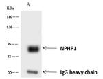 NPHP1 Antibody in Immunoprecipitation (IP)