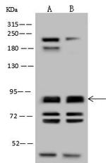 NPHP1 Antibody in Western Blot (WB)