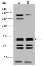 NPHP1 Antibody in Western Blot (WB)