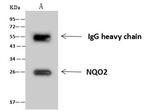 NQO2 Antibody in Immunoprecipitation (IP)