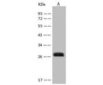 NQO2 Antibody in Western Blot (WB)
