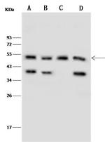 NR5A1 Antibody in Western Blot (WB)