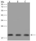 NUDCD2 Antibody in Western Blot (WB)