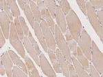 OSMR Antibody in Immunohistochemistry (Paraffin) (IHC (P))