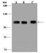OSMR Antibody in Western Blot (WB)