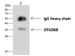 OTUD6B Antibody in Immunoprecipitation (IP)