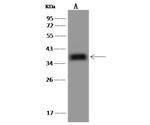 OTUD6B Polyclonal Antibody