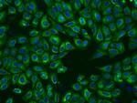 P4HA2 Polyclonal Antibody
