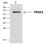 P4HA2 Antibody in Immunoprecipitation (IP)