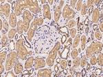 PACSIN2 Polyclonal Antibody