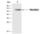 PACSIN2 Antibody in Immunoprecipitation (IP)