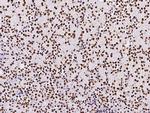 PAX2 Antibody in Immunohistochemistry (Paraffin) (IHC (P))