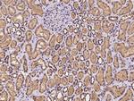 Alix Polyclonal Antibody