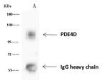PDE4D Antibody in Immunoprecipitation (IP)
