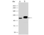 PDE4D Antibody in Western Blot (WB)