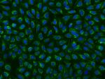 PDHX Polyclonal Antibody