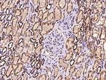 PDHX Antibody in Immunohistochemistry (Paraffin) (IHC (P))