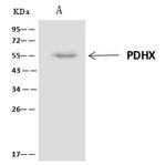 PDHX Antibody in Immunoprecipitation (IP)