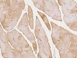 PDLIM5 Antibody in Immunohistochemistry (Paraffin) (IHC (P))