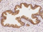 PDLIM5 Antibody in Immunohistochemistry (Paraffin) (IHC (P))