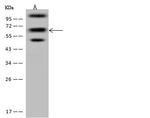 PDLIM5 Antibody in Western Blot (WB)