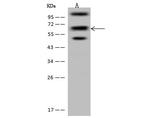 PDLIM5 Antibody in Western Blot (WB)