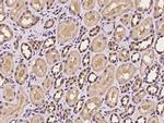 PDXK Antibody in Immunohistochemistry (Paraffin) (IHC (P))