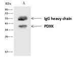 PDXK Antibody in Immunoprecipitation (IP)