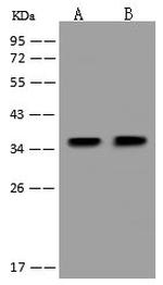 PDXK Antibody in Western Blot (WB)
