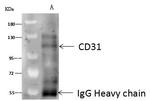 CD31 Antibody in Immunoprecipitation (IP)