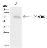 PFKFB4 Antibody in Immunoprecipitation (IP)