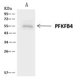 PFKFB4 Antibody in Immunoprecipitation (IP)