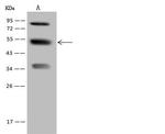 PFKFB4 Antibody in Western Blot (WB)