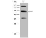 PFKFB4 Antibody in Western Blot (WB)