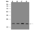 PIGP Polyclonal Antibody