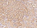 PIKFYVE Antibody in Immunohistochemistry (Paraffin) (IHC (P))