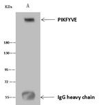 PIKFYVE Antibody in Immunoprecipitation (IP)
