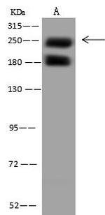 PIKFYVE Antibody in Western Blot (WB)