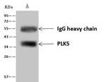 PLK5 Antibody in Immunoprecipitation (IP)