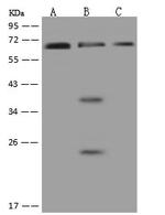 PNK Polyclonal Antibody