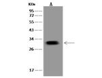 PNMT Polyclonal Antibody