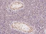 POLB Antibody in Immunohistochemistry (Paraffin) (IHC (P))