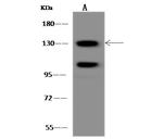 POLR2B Polyclonal Antibody