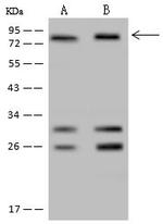 POLR3E Polyclonal Antibody