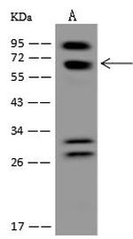 POMGNT2 Polyclonal Antibody