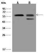 PPAT Polyclonal Antibody