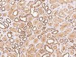 PPME1 Antibody in Immunohistochemistry (Paraffin) (IHC (P))