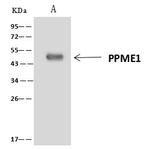PPME1 Antibody in Immunoprecipitation (IP)