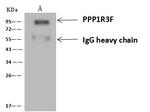 PPP1R3F Antibody in Immunoprecipitation (IP)