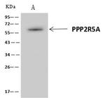 PPP2R5A Antibody in Immunoprecipitation (IP)